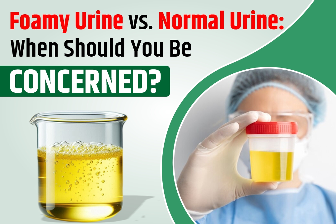 Foamy Urine vs. Normal Urine:  When Should You Be Concerned?